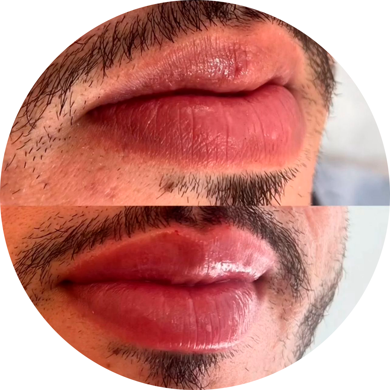 Tratamentos